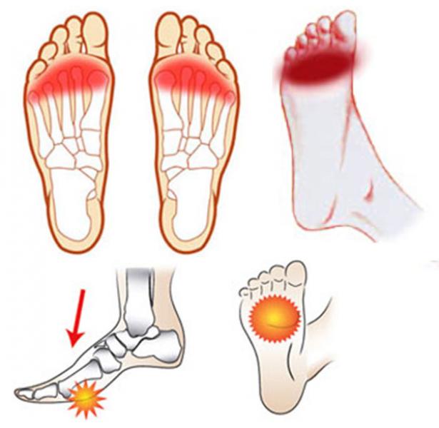 tratament articular fix articulațiile din degete doare ce să facă